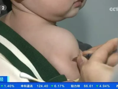 春季手足口病易感 疾控中心提醒5岁以下儿童要做好健康监测“狗官”的由来:揭秘侮辱大臣的3个皇帝