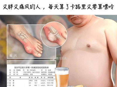 尿酸高,都是吃出来的吗?