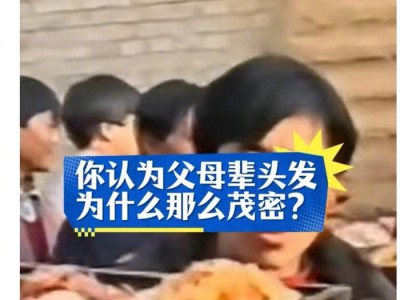 专家解析父母辈头发茂密现象,探讨洗头与脱发关系