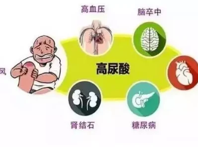 痛风和高尿酸,到底有啥不一样?一文说清“喜欢的对象要自己挑”