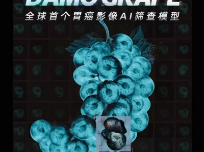 阿里达摩院联合发布全球首个胃癌影像筛查 AI 模型 DAMO GRAPE彻底混不下去了！官方通报不到72小时，那尔那茜再迎4个噩耗