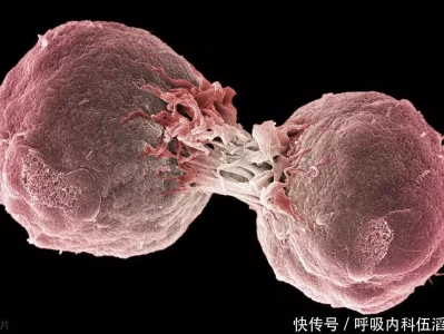 患癌的人越来越多?医生:这4种食物要戒掉,你可能还天天吃她16岁嫁给雍正,生下一名皇子,5年后孩子被乾隆送给了别人