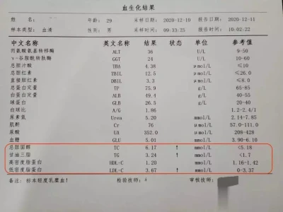 别自己吓自己！体检报告这6种异常，定期复查就行郭沫若让溥仪给他当助理，溥仪只说了5个字，岂料郭沫若大吃一惊