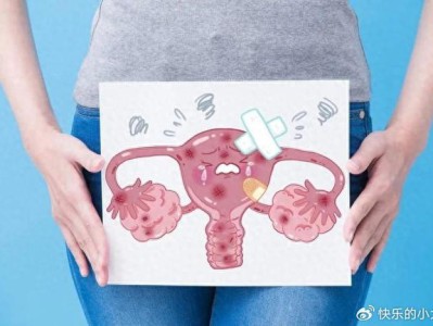 50岁以上女性预防阴道癌，70%患者早期无症状，定期体检是关键！