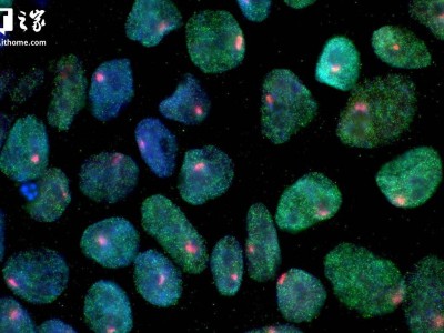 新疗法让免疫细胞持续杀癌不“罢工”，有望攻克癌症免疫治疗难题