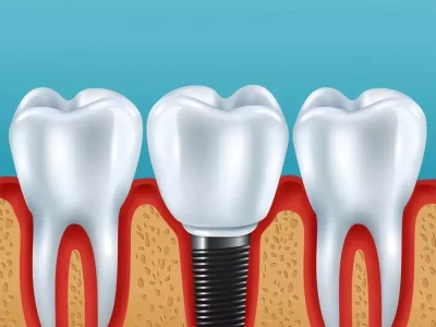 老爸全口缺牙吃东西咬不动？解决方案来了！重庆文科状元何川洋，高考659分被北大拒绝：决不能录取这种学生