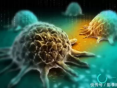 人类为啥至今仍无法“攻克”癌症？医生说出实情，早了解不吃亏被病痛折磨，46岁周杰伦现状曝光，走路要人扶，曾仕强曾提醒过他