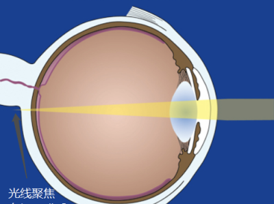 孩子没有了远视储备怎么办？多望远处可以增加吗？