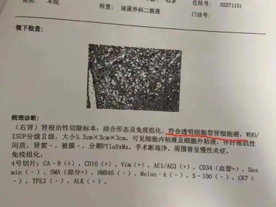 体检10年未预警却患癌症，体检是否还有意义？
