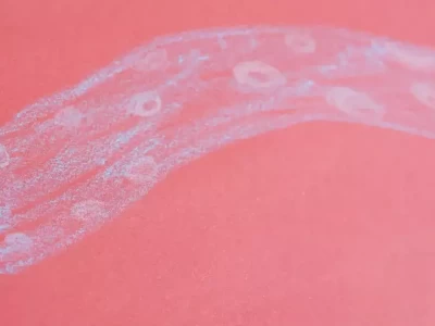 高血脂咋预防？2个关键要点，助你及时防治，赶紧收藏！卸妆后明星现原形！卤蛋脸、黄牙、鞋拔子脸扎堆，沈腾都忍不了