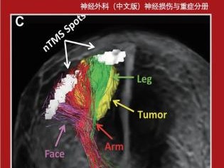 中枢神经系统功能恢复：转化神经科学原理综述