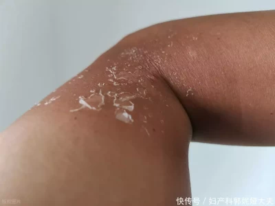 腿痒，一查竟是癌症！医生提醒：许多人发现时已是晚期探秘《红楼梦》：贾家兴盛依仗何人，贾元春是关键？