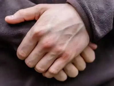 高血压不是凭空来的！这几个原因，打工人不得不防！女生喜欢藏在“嘴”里，喜欢你时是这种状态！