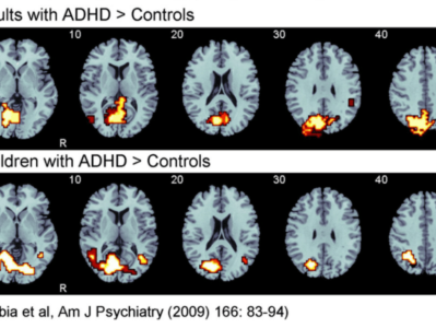 科学证据告诉你，正念练习不是玄学，是ADHD的“脑部健身房”