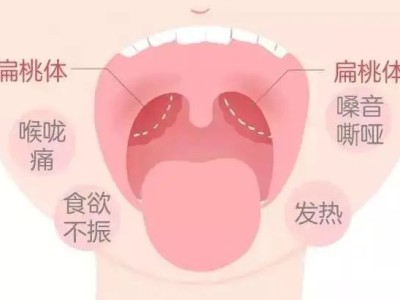 秋季天气干燥容易上火，缓解咽喉不适的自然疗法，试一下这些办法来镇痛……