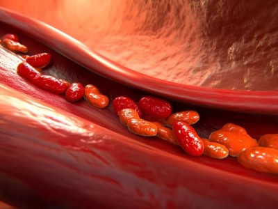 晨起后有这3种表现，说明你的血管不健康→