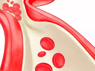 心脑血管疾病很可怕？其实饮食上坚持“2少3多”，血管会很健康遭开除军籍、全家移民、骗财骗色，他身上标签哪个是真的