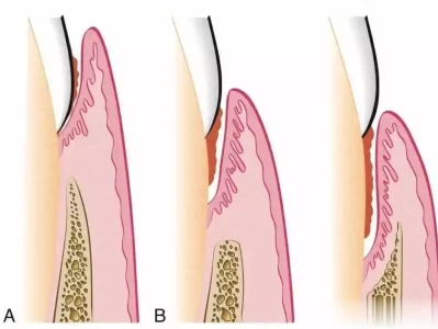 别不当回事！快看看你的牙！ 快来！植物大战僵尸这些彩蛋你发现了吗？