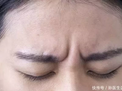 长不长寿，眉毛先知？过了50岁，眉毛浓密的人更长寿？医生来揭秘正式退出！全红婵作出意外决定，中国跳水队无奈批准，陈芋汐祝福