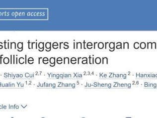 【前沿进展】Cell丨张兵实验室发现间歇性禁食抑制毛囊再生的机制