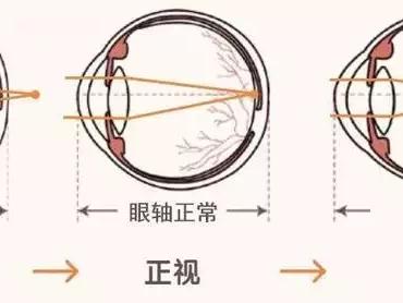 快行动！帮孩子筑牢视力保护的坚固防线！150斤微胖穿搭