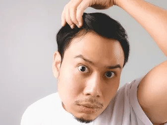 脱发不再是困扰？新型药物治疗半年后，这些严重脱发患者有望重回80%的头发覆盖率