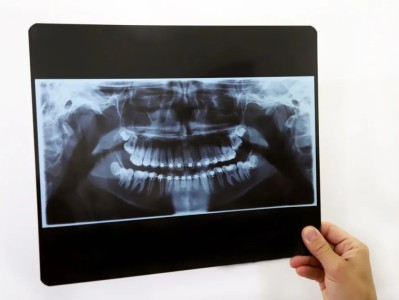 “静”享健康｜守护牙齿健康的 “透视眼”