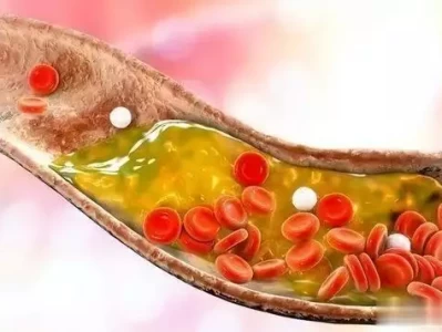 高血压患者注意！补2种维生素预防脑梗，年轻人也得知道？72岁“唐僧”开始卖房！和陈丽华33年感情成笑话，百亿财产成空？