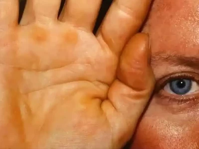 肾脏健康和这几个生活习惯竟有大关系？若尔盖发现一蠢萌小动物，爪子当“挖土机”，12分钟挖70厘米地道